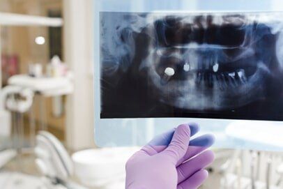 Digital dental x-ray review at Centerpointe Dental in Burnsville and Lakeville, MN